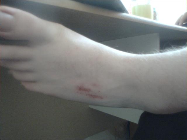 Foot thing.jpg