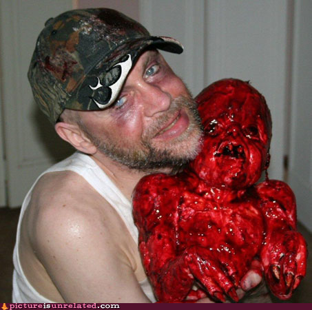 JamesB-bloody.jpg