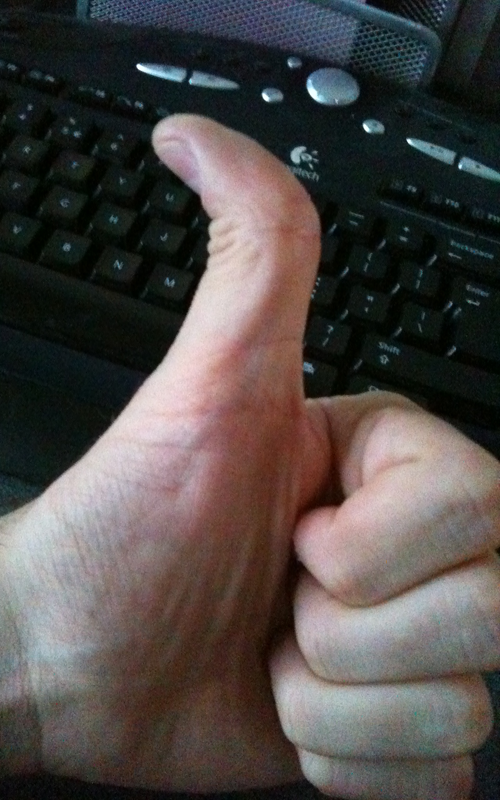 thumbs..up.png